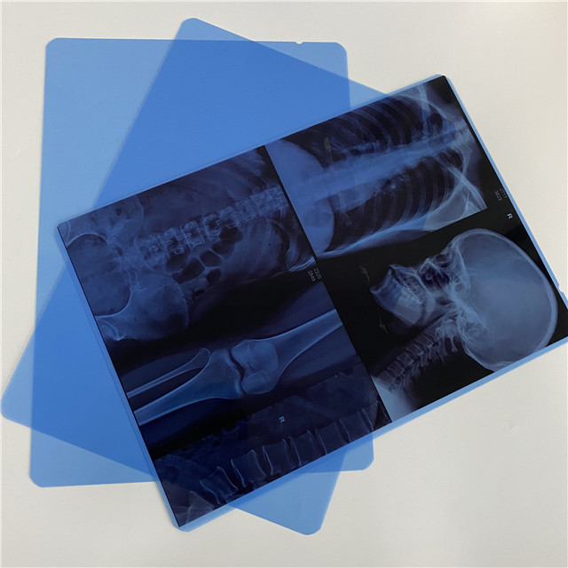 Película azul de rayos X de inyección de tinta para imágenes médicas de 14x17 IN 210mic